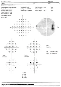Multi-panel figure with several dot-plot diagrams showing axes, grids, and statistical annotations.