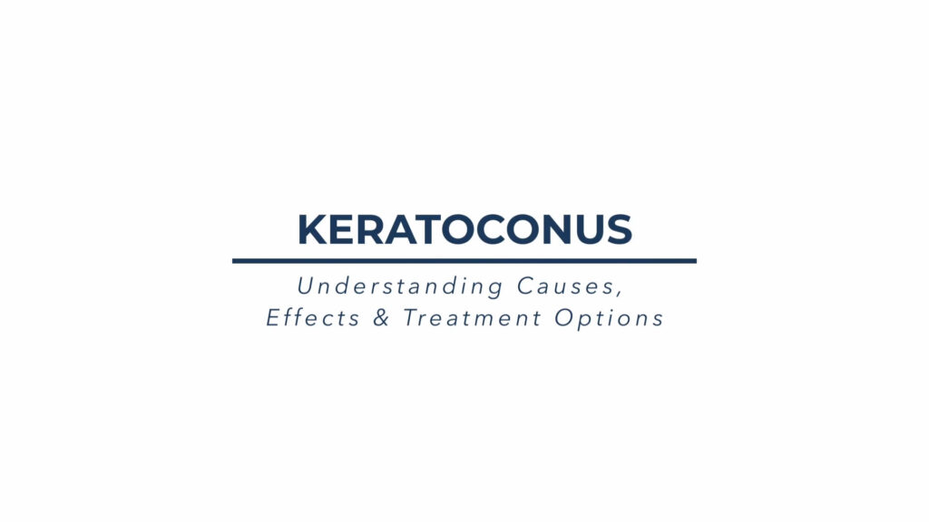 Keratoconus thumbnail