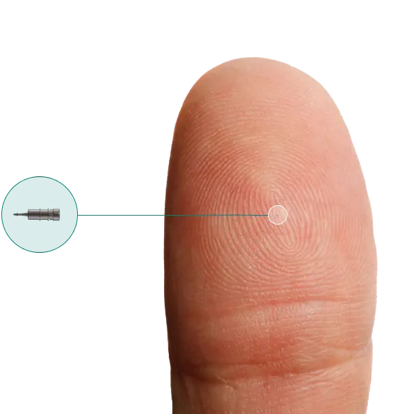 Scale reference image of iDose TR implant
