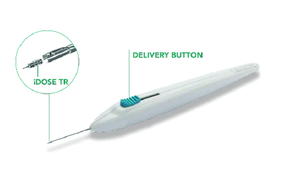 Imagery of the iDose TR implant device.