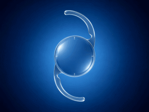 Toric cataract lens option for correcting astigmatism at Wellish Abrams Vision Institute