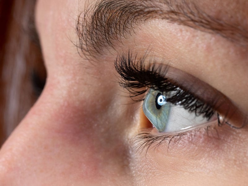 Woman seeking keratoconus treatment at Wellish Abrams.
